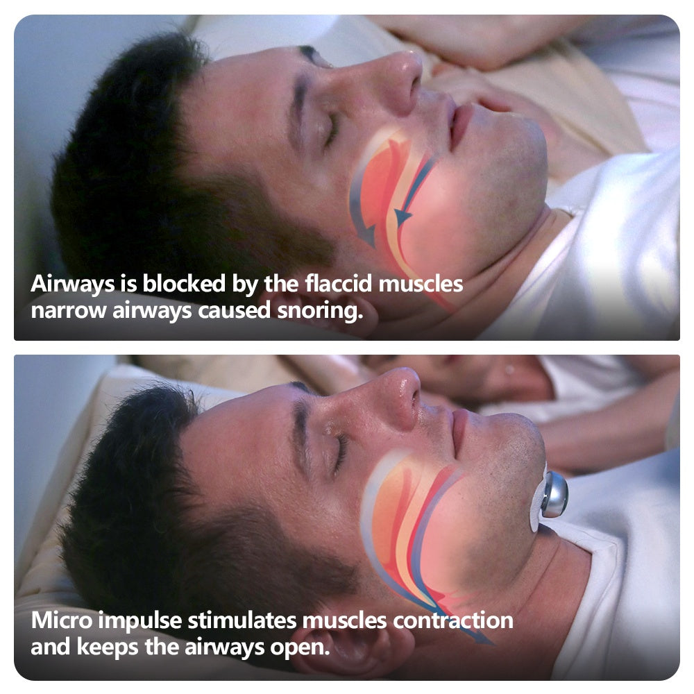 Smart Snore Stopper Electronic Muscle Stimulator Pro